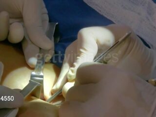Aj taguan mula sa hangin mula wwe makakakuha ng kanya third dibdib implant: Libre malaswa video 8e